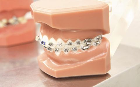 インプラントから矯正まで