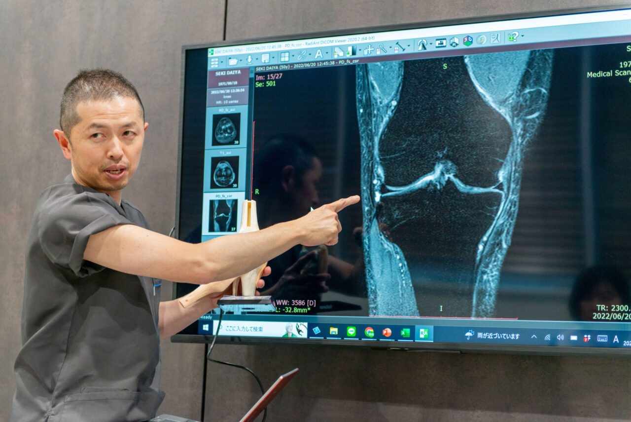 膝再生治療のエキスパート