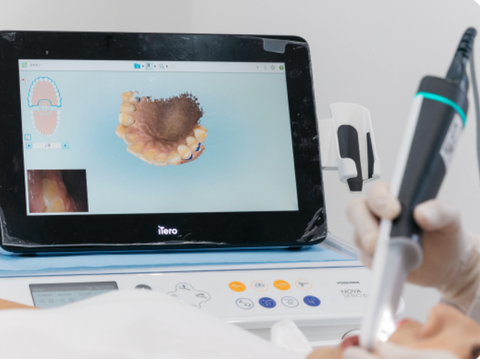 マウスピースや裏側矯正で目立たずに